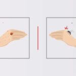 Flea Bites Vs Mosquito Bites