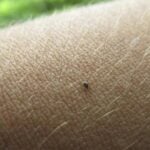 How to Get Rid of Seed Ticks on Dogs
